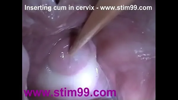 XXX کل فلموں Insertion Semen Cum in Cervix Wide Stretching Pussy Speculum