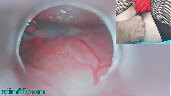 XXX Uncensored Japanese Insemination with Cum into Uterus and Endoscope Camera by Cervix to watch inside womb jumlah Filem